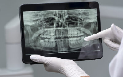 Imagistica dentară – baza unui diagnostic corect și precis