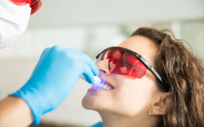 Albirea dentară – metode moderne pentru un zâmbet mai strălucitor